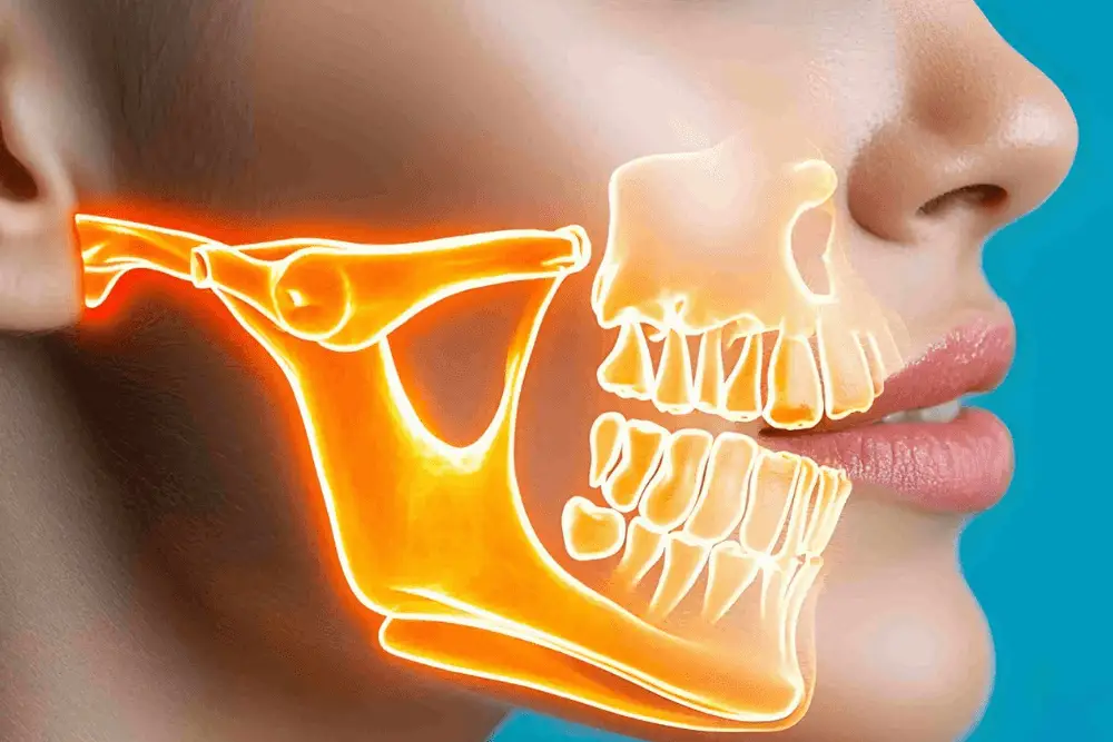 عقب ماندگی فک پایین